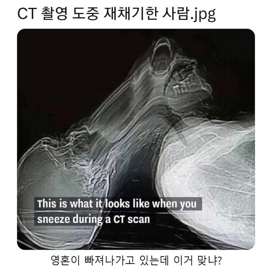 BlockNote image