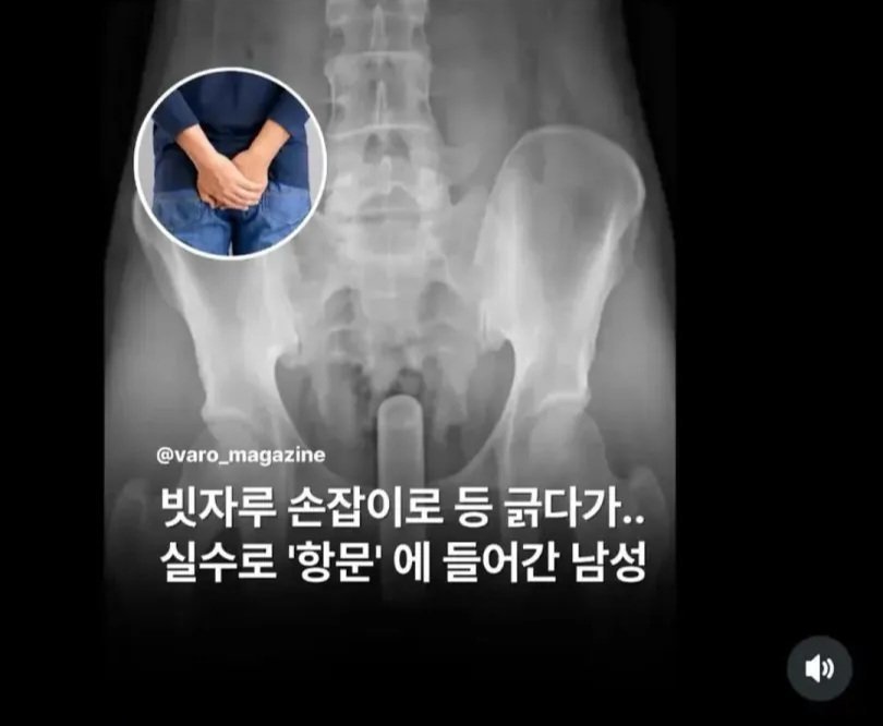 BlockNote image
